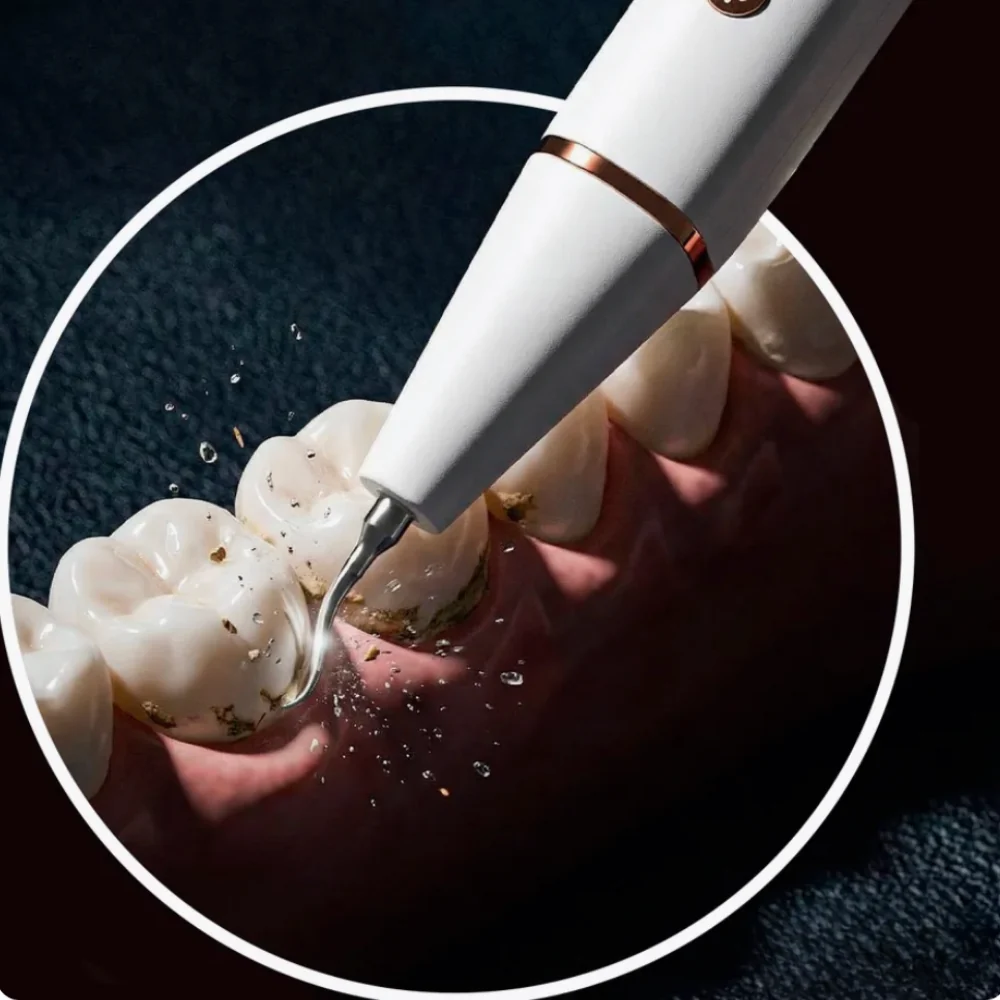 GlowSmile™ – Ultraljudsrengöring - Bild 6
